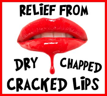 Santa Fe dentists, Dr. Giron & Dr. Detrik at Vida Dental Studio, tells you how to relieve your dry, chapped, and cracked lips!
