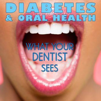 Santa Fe dentist, Dr. Giron & Dr. Detrik of VIDA Dental Studio, discusses the side effects of diabetes and how it affects your oral health.