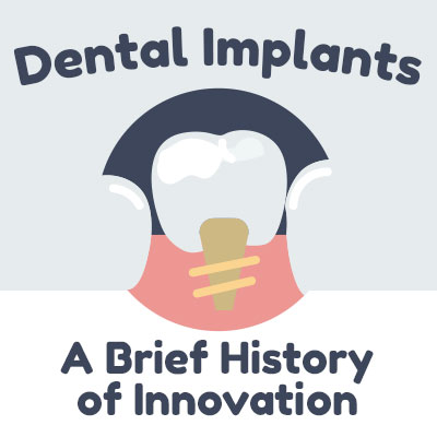 Santa Fe dentists, Dr. Giron & Dr. Detrik of VIDA Dental Studio discuss dental implants and shares some information about their history.