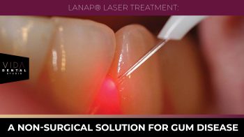 Discover LANAP laser treatment for gum disease at VIDA Dental Studio in Santa Fe, NM. A non-surgical alternative offering minimal pain, faster recovery, and effective results. Reclaim your gum health!