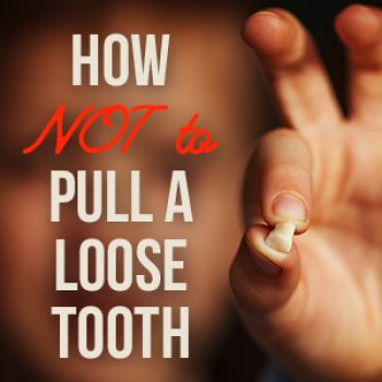 Santa Fe dentists, Dr. Giron & Dr. Detrik at Vida Dental Studio, tell parents the do’s and don’ts of pulling your child’s loose baby teeth for the safest and most painless experience.