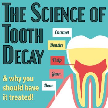 Santa Fe dentist, Dr. Giron & Dr. Detrik of Vida Dental Studio, discusses the science of tooth decay: what it is and what you can do to prevent it.