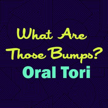 Santa Fe dentists, Dr. Giron & Dr. Detrik at Vida Dental Studio explains oral tori—what they are, why they happen, and whether they are a cause for concern.