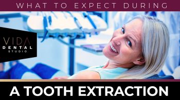 Learn what happens during tooth extractions in Santa Fe. Our expert team ensures a comfortable experience. Schedule your consultation today!