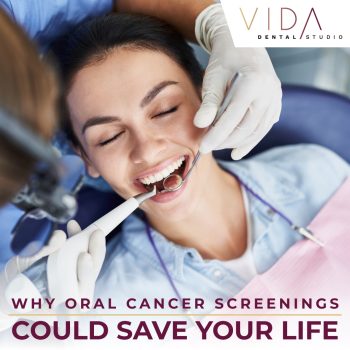 Learn why oral cancer screenings are vital. Santa Fe’s dentist, Dr. Giron at VIDA Dental, explains the importance, early detection and how this simple test can save your life.