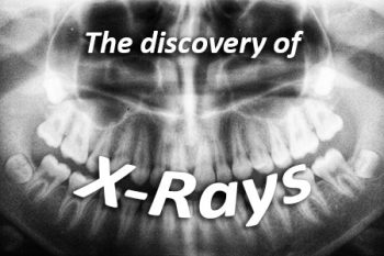 Santa Fe dentist, Dr. Giron at Vida Dental Studio, discusses the discovery of X-rays and how they have advanced over the years.